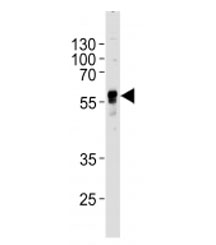 Western blot analysis of lysate from human SH-SY5Y cell line using ABHD3 antibody at 1:1000 for each lane. Predicted molecular weight ~46 kDa.