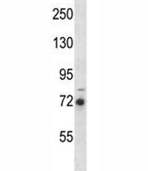 RIPK1 antibody western blot analysis in MDA-MB231 lysate.