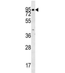 ABP1 antibody western blot analysis in human K562 lysate. Predicted molecular weight ~85 kDa.