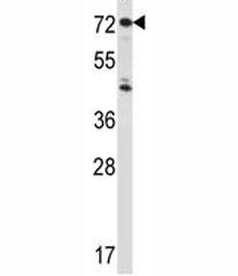 IL1R1 antibody western blot analysis in HepG2 lysate.