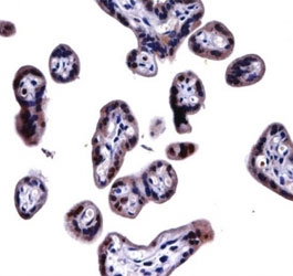 SOCS6 antibody immunohistochemistry analysis in formalin fixed and paraffin embedded human placenta tissue.