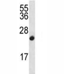 CDKN2B antibody western blot analysis in CEM lysate