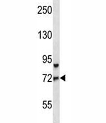 FOXO3 antibody western blot analysis in CEM lysate. Expected molecular weight: 71-90 kDa depending on glycosylation level.