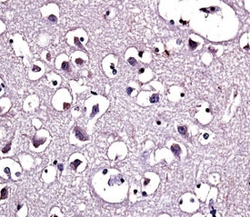 LPL antibody immunohistochemistry analysis in formalin fixed and paraffin embedded human brain tissue.