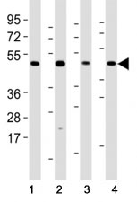 Western blot testing of Mlkl antibody at 1:2000 dilution and mouse samples: (1) lung, (2) NIH3T3, (3) liver, (4) testis lysate; Predicted size: 54 kDa.