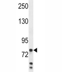Anti-Myeloperoxidase antibody western blot analysis in MDA-MB231 lysate. Expected molecular weight: 59-64 kDa (alpha chain, may be observed at higher molecular weights due to glycosylation), 150+ kDa (glycosylated mature form).