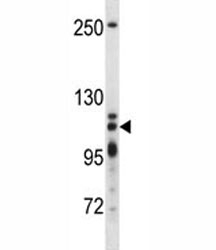 XRN2 antibody western blot analysis in T47D lysate