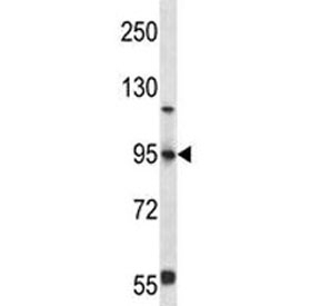 FOXP4 antibody western blot analysis in 293 lysate. Predicted molecular weight: ~73kDa, observed here at ~95kDa.