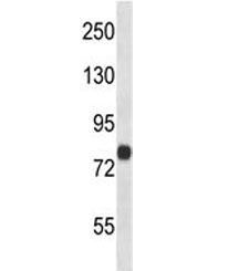 FACL4 antibody western blot analysis in human 293 lysate. Predicted molecular weight ~80 kDa (long form).