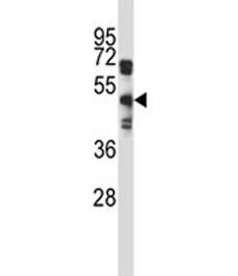 EDG8 antibody western blot analysis in A549 lysate. Predicted molecular weight: ~42kDa.