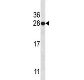 HMGB1 antibody western blot analysis in CEM lysate. Predicted molecular weight ~25 kDa.