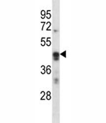 ARC antibody western blot analysis in K562 lysate. Predicted molecular weight ~45 kDa.