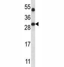 SIRT5 antibody western blot analysis in human placenta tissue lysate.