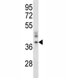 CRACM1 antibody western blot analysis in A375 lysate.