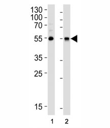 Western blot analysis of lysate from (1) HepG2 cell line and (2) human lung tissue lysate using ALDH1A1 antibody diluted at 1:1000.