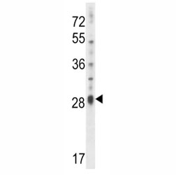 IL17D antibody western blot analysis in NCI-H460 lysate.