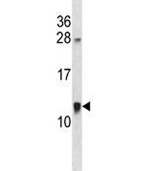 ACBD7 antibody western blot analysis in MDA-MB453 lysate. Predicted molecular weight ~10 kDa.