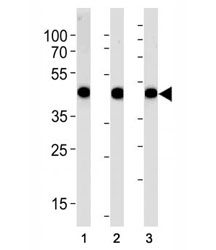 Alpha Actin antibody western blot analysis in (1) A549, (2) RD, and (3) human placenta lysate