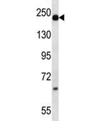 Alpha-2-macroglobulin antibody western blot analysis in mouse plasma lysate. Predicted molecular weight: ~163/200kDa (unmodified/glycosylated).