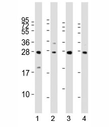 Western blot analysis of LIN28B antibody and 1) HeLa, 2) K562, 3) mouse testis and 4) NCCIT lysate. Predicted molecular weight ~27 kDa.