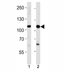 SALL4 antibody western blot analysis in 293,HeLa lysate. Isoform A molecular weight: 112~165 kDa, Isoform B molecular weight: 65~95 kDa.