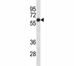 Placental Alkaline Phosphatase antibody western blot analysis in HepG2 lysate