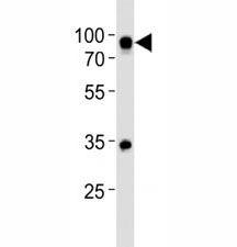 Western blot analysis of lysate from Ramos cell line using CD19 antibody at 1:500.  Expected size is 60~100 kDa depending on glycosylation level.