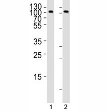 Western blot analysis of lysate from 1) Raji and 2) Ramos cell line using anti-CD19 antibody at 1:1000.  It is a glycoprotein visualized between 60~100 kDa.
