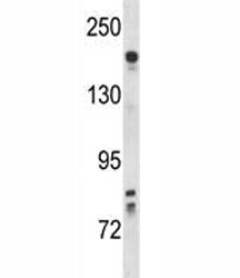 Kdr antibody western blot analysis in mouse lung tissue lysate. Predicted molecular weight: ~152 (immature), 180-200 kDa (intermediate) and 220-230 kDa (mature).