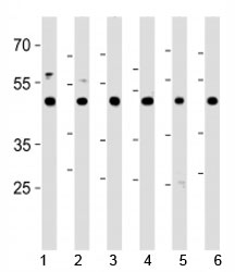CTBP1 antibody western blot analysis in 1) HeLa, 2) HL-60, 3) Jurkat, 4) Raji cell lines, 5) mouse brain and 6) rat brain tissue lysate. Predicted molecular weight ~48 kDa.