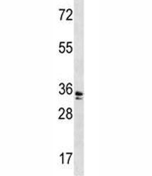 WDR5 antibody western blot analysis in A2058 lysate. Predicted molecular weight ~36 kDa.
