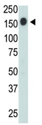 CD45 antibody used in western blot to detect CD45 in Jurkat cell lysate. Expected molecular weight: ~147/180-220 kDa (unmodified/glycosylated).