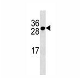 BCMA antibody western blot analysis in MDA-MB231 lysate.