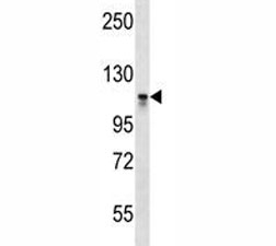 Dnmt3a antibody western blot analysis in CEM lysate. Predicted molecular weight: 100-130 kDa