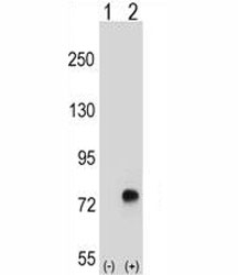 Western blot analysis of TGFBI antibody and 293 cell lysate either nontransfected (Lane 1) or transiently transfected (2) with the TGFBI gene.