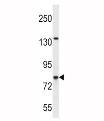 CPT1B antibody western blot analysis in SK-BR-3 lysate. Predicted molecular weight ~88kDa.