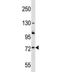 ACOX2 antibody western blot analysis in A375 lysate. Predicted molecular weight: ~75kDa.