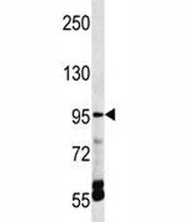 TRPV5 antibody western blot analysis in HepG2 lysate.