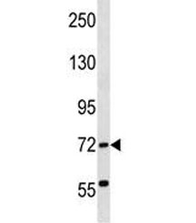 ABCF2 antibody western blot analysis in human K562 lysate. Predicted molecular weight ~71 kDa.