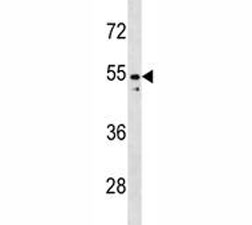 PAX2 antibody western blot analysis in K562 lysate