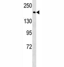 BRCA1 antibody western blot analysis in HeLa lysate. Predicted molecular weight ~207 kDa, commonly observed at 207-220 kDa.