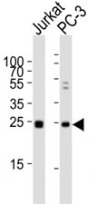 Western blot analysis of lysate from human Jurkat and rat PC-3 lysate using HMGB4 antibody diluted at 1:1000.