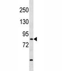 TBR1 antibody western blot analysis in mouse bladder tissue lysate