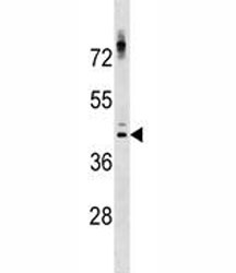 NKX2.1 antibody western blot analysis in ZR-75-1 lysate.