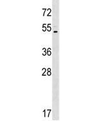 Western blot testing of human K562 lysate with ASIC5 antibody at 1:500. Predicted molecular weight ~57 kDa.
