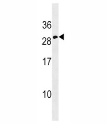Erythropoietin antibody western blot analysis in CEM lysate. Predicted molecular weight: 18-34 kDa depending on glycosylation level.