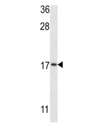 Western blot analysis of LC3B antibody and MCF-7 lysate