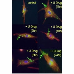 Mouse leukaemic monocyte macrophage cells treated with drug U18666A, causing cholesterol and lipid storage in cells, blocking fusion between late endosomes and lysosomes. LC3B antibody detected punctuate staining indicative of autophagic vacuole or phagosome structures.