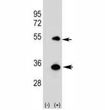 Western blot analysis of ATG5 antibody and 293 cell lysate (2 ug/lane) either nontransfected (Lane 1) or transiently transfected (2) with the human gene. Predicted molecular weight ATG5: ~32 kDa; ATG5/ATG12 heterodimer: ~56 kDa.
