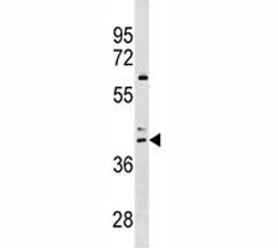 CCR4 antibody western blot analysis in HL-60 lysate. Predicted molecular weight ~41 kDa.